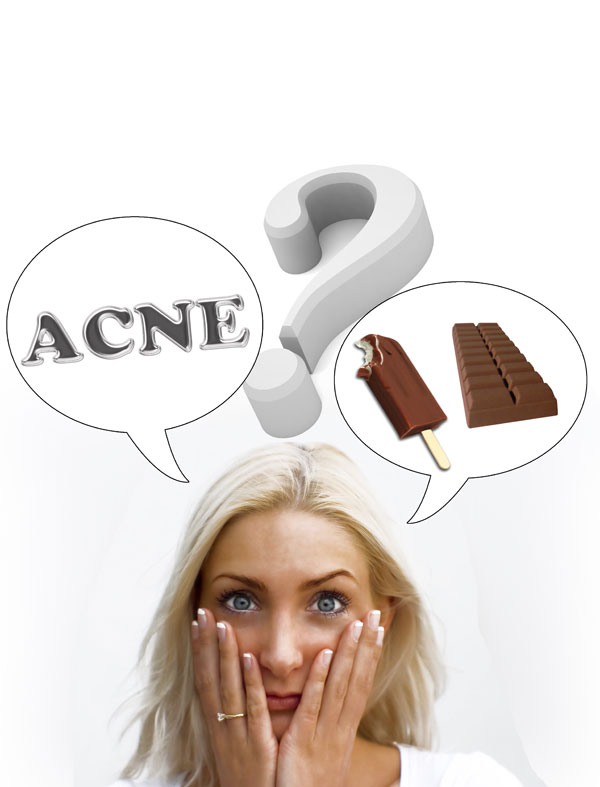 Acne X chocolate Acne X chocolate