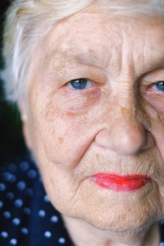 Idade está entre fatores de risco para o Glaucoma