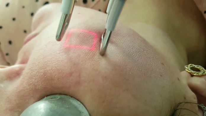 tratamentos a laser na dermatologia