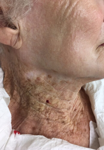 Skincare para o pescoço Foto Christian Posch - Journal of The European Academy of Dermatology and Venereology